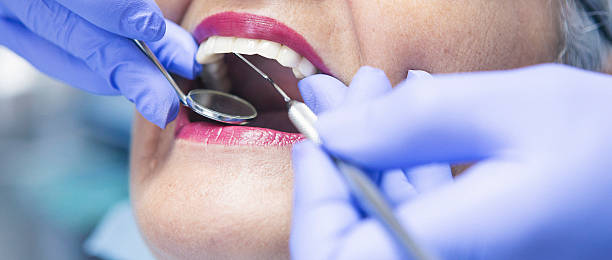 Best Emergency Treatment for Toothache in Astor, FL